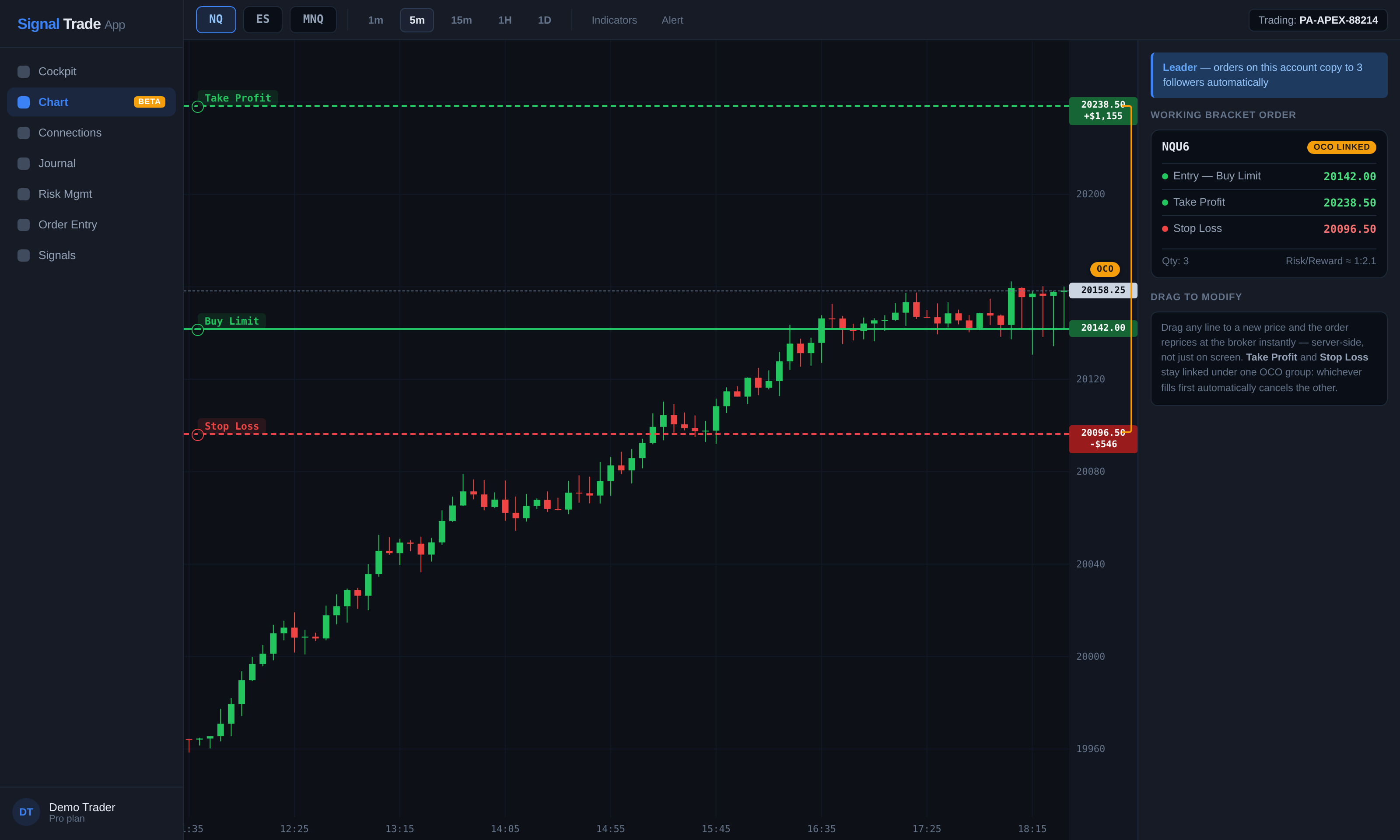 Signal Trade App /chart page showing an NQ candlestick chart with draggable Buy Limit entry, Take Profit, and Stop Loss order lines, an OCO-linked badge connecting the take-profit and stop-loss legs, and a working bracket order panel on the right